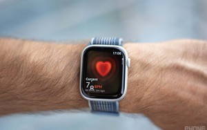 Gần 10 năm ra mắt, vì sao Apple Watch vẫn món đồ công nghệ "vô dụng và phí tiền" nhất?