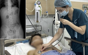 5 giờ phẫu thuật cho thiếu niên 15 tuổi bị cành cây đâm xuyên vùng hậu môn khi nhảy xuống ao tắm