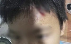 Điều tra vụ bé trai 10 tuổi nghi bị mẹ kế tiếp tục bạo hành