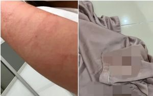 Cô gái bị bạn trai đánh đập tàn nhẫn ngay giữa cao tốc, đang lúc nguy cấp thì chuyện bất ngờ xảy ra