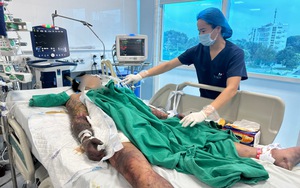 Thanh niên 27 tuổi ở Bắc Ninh rơi vào hôn mê, suy đa tạng sau khi ăn 1 món để "lấy may"