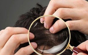 Không phải cứ có tóc bạc là lão hóa: Có 2 loại tóc trắng này trên đầu thì bạn cần đi khám sớm xem có mắc bệnh nào không