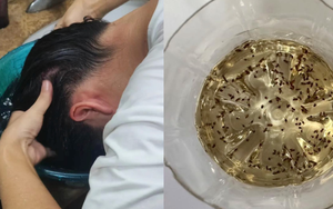 Lần đầu tiên sau 40 năm cuộc đời phát hiện: 9 sự "bá đạo" của giấm trắng