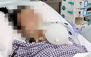 Người phụ nữ nguy kịch, suy hô hấp sau khi làm 1 việc để xóa nếp nhăn