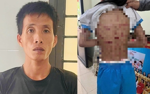 Nguyễn Văn Nam, gã cha dượng đánh đập tàn bạo bé gái lớp 5, đối diện với hình phạt gì?