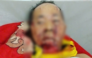 Trưởng thôn ở Đà Nẵng bị gấu rừng tấn công