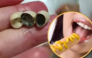 Hãi hùng: Phát hiện răng giả trong bánh, xúc xích, dimsum - Dư luận Trung Quốc dậy sóng