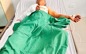 Công an thông tin vụ đôi nam nữ bị truy sát trong phòng trọ