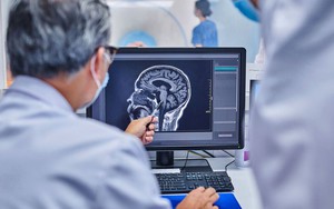 Cảnh báo: Nguy cơ đột quỵ tăng 86% ở những người có đặc điểm này ở miệng