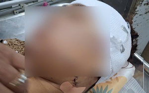 Nghi vấn nữ cán bộ xã ở Đồng Tháp rạch mặt người phụ nữ nhậu với chồng