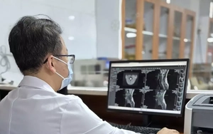 Mỗi ngày hít 240 đến 320 quả bóng cười, hai vợ chồng liệt, tổn thương tủy sống