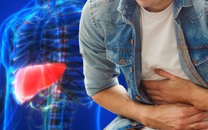 Gan tổn thương nghiêm trọng sau khi uống thứ này suốt 6 tháng: Không phải rượu bia