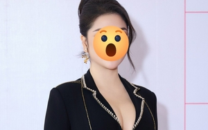 Hoa hậu Việt mắc bệnh lạ: Thường lên cơn co giật, bị bệnh viện trả về, 10 ngón tay đều có sẹo