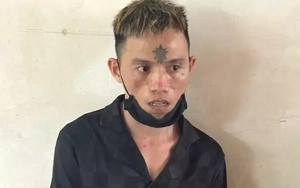 Cô gái bị kề dao vào cổ, cướp điện thoại ở công viên