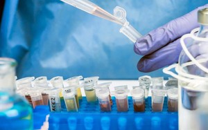 WHO báo động loại virus tái xuất sau 30 năm, gây liệt vĩnh viễn hoặc tử vong, đặc biệt ở trẻ em dưới 5 tuổi