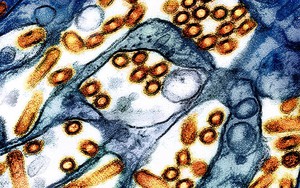 Phát hiện chủng virus cúm gia cầm chưa từng thấy ở người tại Mỹ