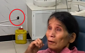 Ớn lạnh cảnh con đỉa sống trong mũi người phụ nữ suốt 3 tuần