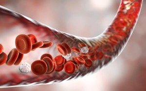 Mạch máu bị tổn thương chỉ sau 4 tiếng ăn loại thực phẩm này: Món "khoái khẩu" của rất nhiều người Việt