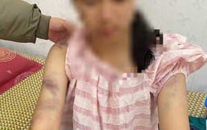 Mẹ bé gái bị bạo hành ở Thái Nguyên: Con bị đánh suốt 4 tiếng, dọa rút móng tay