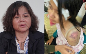 Vụ bà nội bạo hành cháu gái: Bắt Nguyễn Thị Bích Hằng sinh năm 1969