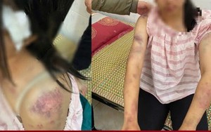 Ba kẻ tra tấn cháu gái suốt 4 giờ có thể bị khởi tố thêm nhiều tội danh