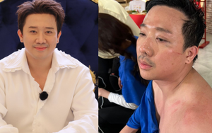 Trấn Thành kiệt quệ