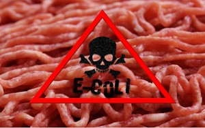 Giáo sư Mỹ tiết lộ 3 loại thực phẩm chứa độc tố, có thể gây ung thư: Nếu thấy phải vứt bỏ ngay!