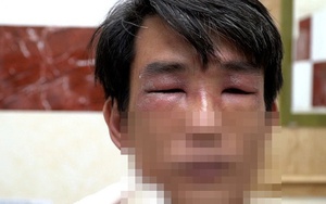 TP HCM vào mùa kiến ba khoang: cảnh báo người dân kiểm tra chăn màn