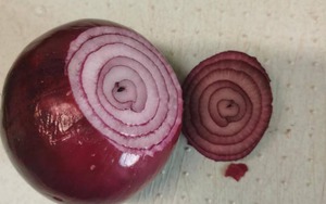 Hành tây có 4 công dụng thần kỳ, ai không biết thì rất thiệt