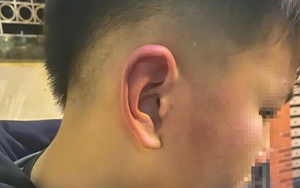 Phân định pháp lý vụ bé trai 12 tuổi bị bố bạn tát, đánh vào đầu