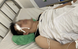 Xe buýt va chạm nhẹ với xe con, tài xế bị đánh chấn thương sọ não