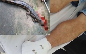 Vụ cá sấu cắn thầy giáo ở Tây Ninh: Phạt người nuôi 315 triệu đồng