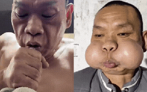 Nỗi khổ của “hoàng tử ếch”