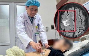 Người đàn ông Hà Nội tổn thương não diện rộng do nguyên nhân bất ngờ - không phải khối u