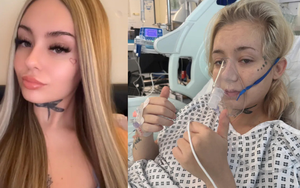 Cô gái 21 tuổi bị ung thư phổi sau 6 năm duy trì 1 sở thích vạn người trẻ mê