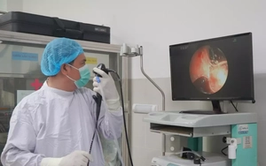 Đà Nẵng: Răng giả ‘thường trú’ trong phổi người đàn ông suốt 20 năm, liên tục gây viêm sốt