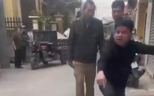 Hà Nội: Xác minh thông tin thả chó cắn vào mặt, chân người phụ nữ đi đường