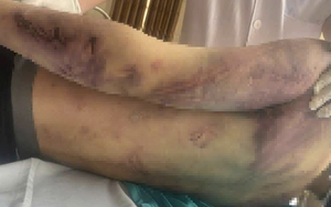 Tạm đình chỉ Trung tâm Công tác xã hội Hải Hà để điều tra vụ học viên bị đánh tử vong