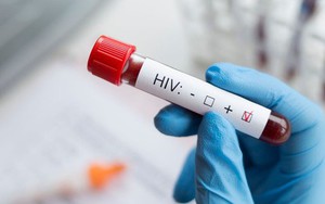 Đi khám sức khỏe định kỳ, nam shipper 35 tuổi phát hiện nhiễm HIV: Choáng váng khi biết nguồn lây