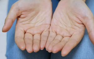 Nam giới mắc bệnh thận, thường xuyên ra mồ hôi ở 5 vị trí này