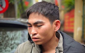 Nam shipper bị tài xế Lexus đánh tới tấp: 'Tôi vẫn đau đầu, choáng váng'