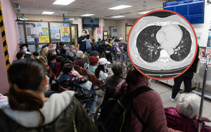 Một nhà 5 người đồng loạt mắc cúm sau chuyến đi chơi, có người biến chứng nặng, trắng phổi vì bỏ lỡ "48 giờ vàng"