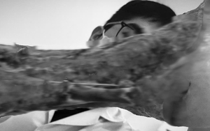 Tài công tàu biển bị "vi khuẩn ăn thịt người" tấn công