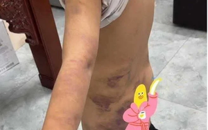 Đưa 3 nam sinh về quán karaoke tra hỏi, đánh cho tím người