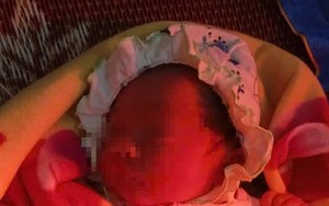 Bé sơ sinh còn nguyên dây rốn bị bỏ rơi trong túi nilon