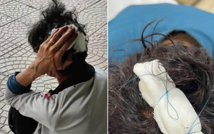 Xác minh vụ nam shipper ở Bình Dương bị chém khi đi giao hàng