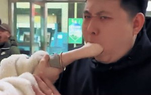 Cô gái mắc kẹt cả bàn tay trong miệng bạn trai, bác sỹ vất vả xử lý