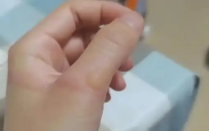 Bé trai 3 tuổi bị bỏng nước sôi 100 độ C, hành động của người bà trong “60 giây vàng” được bác sĩ khen ngợi