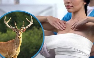 Bị biến dạng vòng 1 sau khi chi 8,4 tỷ đồng nâng ngực, cô gái sốc nặng khi phát hiện sự thật đáng sợ
