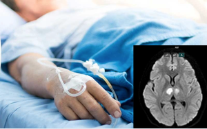 Tổn thương não, liệt tứ chi vì 1 thói quen nhiều người Việt mắc: Bác sĩ thốt lên ‘thật khó chấp nhận’